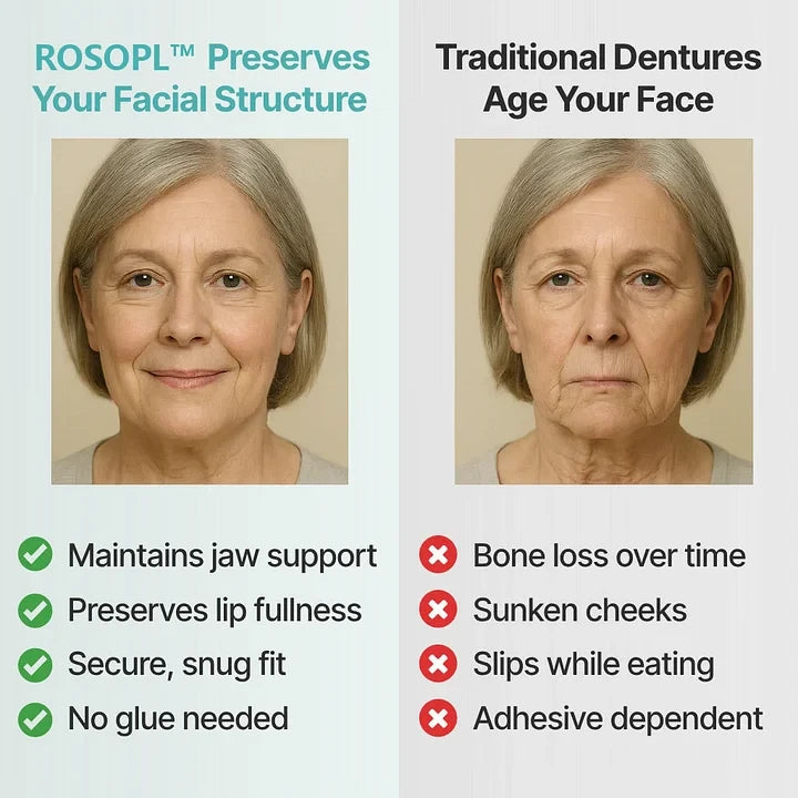 🌎Ends Today: 70% OFF! ROSOPLTM Custom-Fit Full Functional DenturesMake you more confident